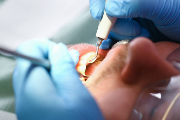 Best Weekend Emergency Dentist in Blue Mountain, MS