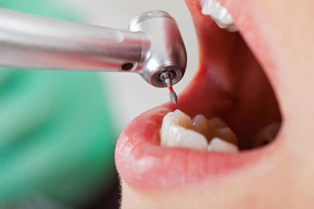 Best 24-Hour Emergency Dentist in Blue Mountain, MS